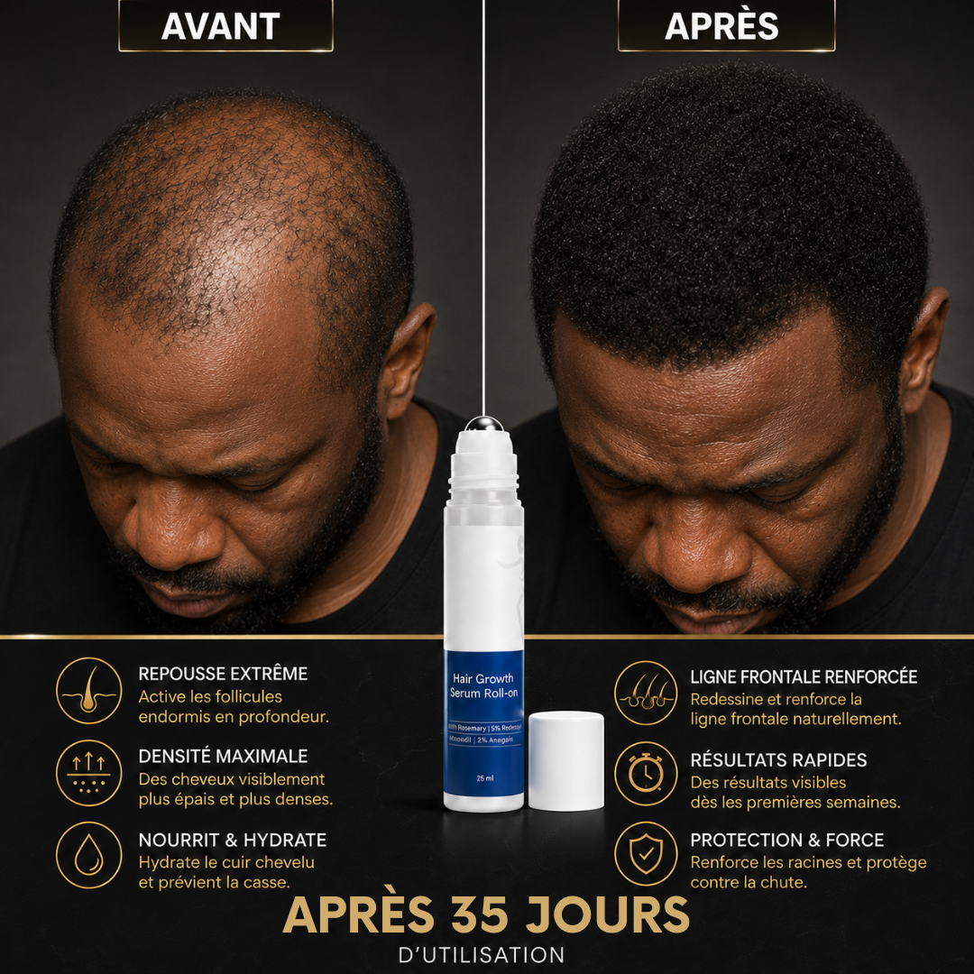 KERAVIVE™: Stoppez la chute de vos cheveux et retrouvez une chevelure plus dense naturellement.