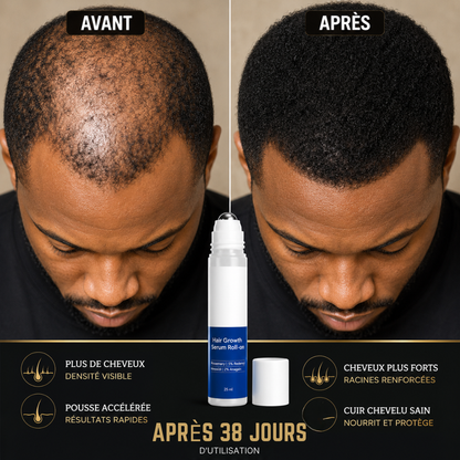 KERAVIVE™: Stoppez la chute de vos cheveux et retrouvez une chevelure plus dense naturellement.